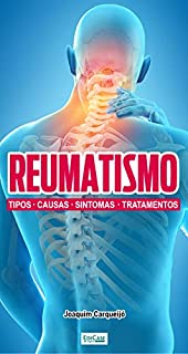 Minibook Reumatismo; Tipos, causas, sintomas e tratamentos